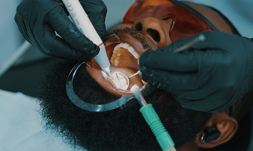 Endodoncia. Tratamientos y especialidades de la Clínica del Camino.