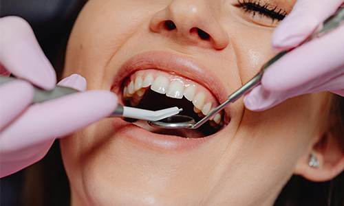 Estética dental. Tratamientos y especialidades de la Clínica del Camino.
