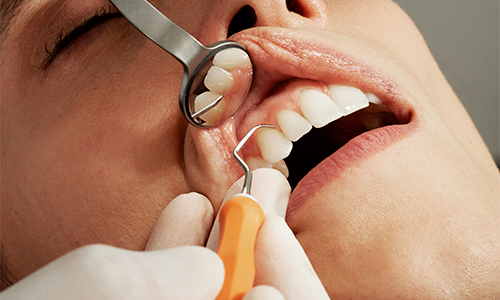 Periodoncia. Tratamientos y especialidades de la Clínica del Camino.