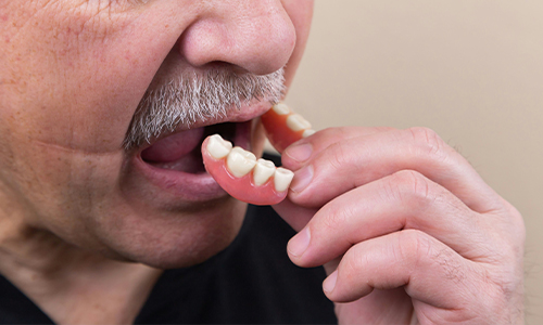 Prótesis dental. Tratamientos y especialidades de la Clínica del Camino.